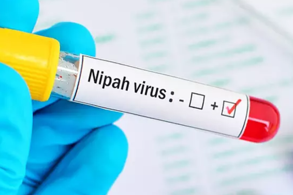 இலங்கையில் நிபா வைரஸ் அச்சுறுத்தலுக்கு முன்கூட்டியே நடவடிக்கை