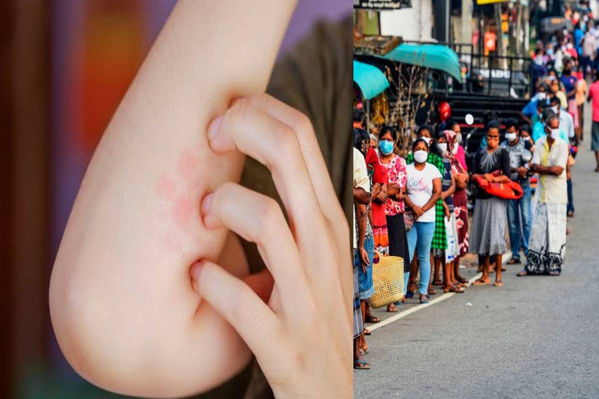 டெங்கு பரவல் தீவிரம்: டெங்கு-2 வைரஸ் ஆதிக்கம் செலுத்துவதாக தேசிய டெங்கு கட்டுப்பாட்டுப் பிரிவு எச்சரிக்கை